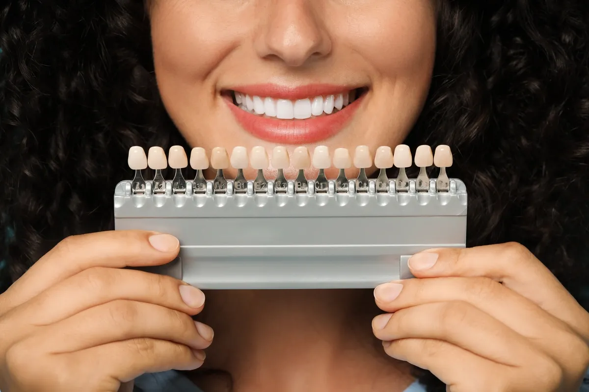 How Much Will Veneers Cost You? Detailed Overview How Much Will Veneers Cost